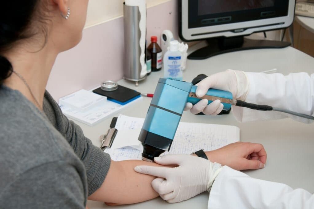 metódy liečby bradavíc na tele